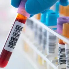 Podwyższone leukocyty: co oznaczają i kiedy szukać pomocy?