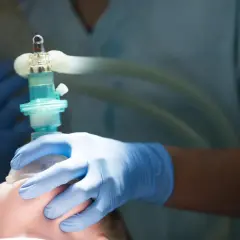 Ręce w niebieskich rękawiczkach trzymają maskę anestetyczną, przygotowując pacjenta do znieczulenia ogólnego.