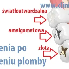 Alkohol po plombowaniu: Odczekaj 24h! Dlaczego to ważne?