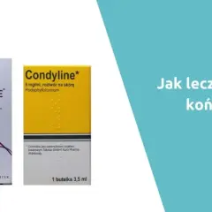 Kłykciny kończyste: Leki bez recepty? Ekspert ostrzega!