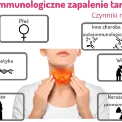 Wysokie anty-TG: Czy tarczyca woła o pomoc? Objawy i leczenie