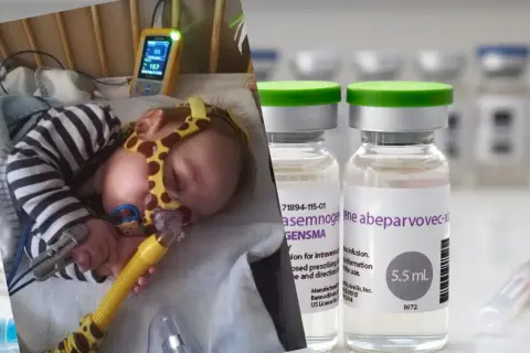 Dziecko podłączone do aparatury medycznej obok fiolek leku Zolgensma.