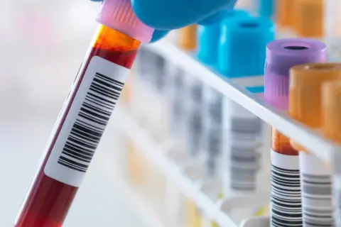 Podwyższone leukocyty: co oznaczają i kiedy szukać pomocy?