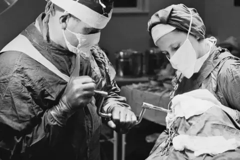 Chirurdzy podczas zabiegu lobotomii. To kontrowersyjna procedura neurochirurgiczna, która polegała na przecięciu połączeń nerwowych w płatach czołowych mózgu.