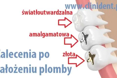 Alkohol po plombowaniu: Odczekaj 24h! Dlaczego to ważne?