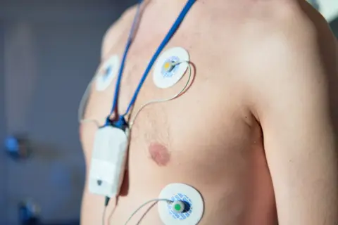 Mężczyzna z elektrodami EKG na klatce piersiowej i podłączonym urządzeniem. To badanie holterowskie, które pomaga ocenić pracę serca.