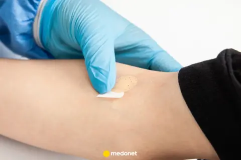 Ręka w niebieskiej rękawiczce zakłada plaster na ramię. Może to być związane z badaniem poziomu hormonów stresu.