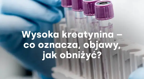 Rękawiczka laboratoryjna trzyma probówki. Tekst: Wysoka kreatynina – co oznacza, objawy, jak obniżyć?