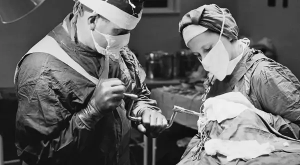 Chirurdzy podczas zabiegu lobotomii. To kontrowersyjna procedura neurochirurgiczna, która polegała na przecięciu połączeń nerwowych w płatach czołowych mózgu.
