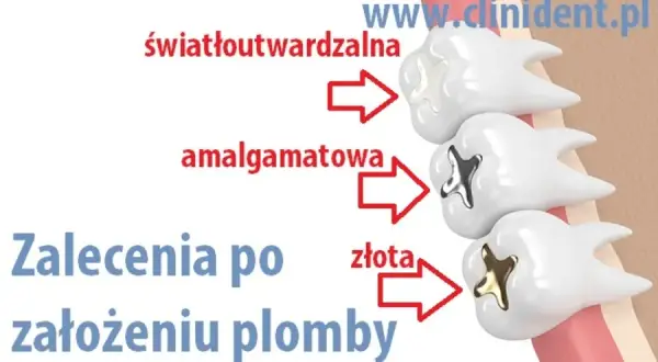Alkohol po plombowaniu: Odczekaj 24h! Dlaczego to ważne?