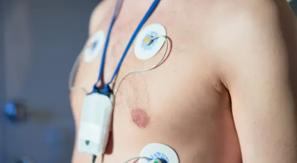 Mężczyzna z elektrodami EKG na klatce piersiowej i podłączonym urządzeniem. To badanie holterowskie, które pomaga ocenić pracę serca.