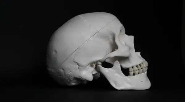 Model ludzkiej czaszki z widoczną linią wskazującą na potencjalną trepanację czaszki.