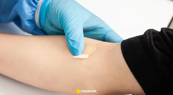 Ręka w niebieskiej rękawiczce zakłada plaster na ramię. Może to być związane z badaniem poziomu hormonów stresu.