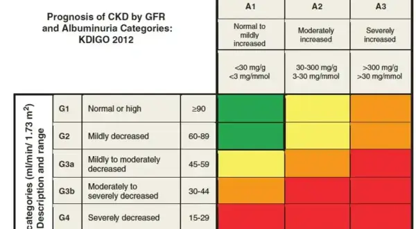 Tabela KDIGO 2012: prognoza PChN wg GFR i albuminurii. Wyniki kreatyniny co to jest, zależą od tych kategorii.