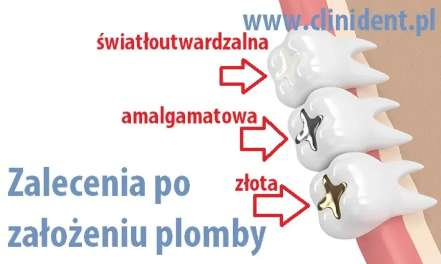 Alkohol po plombowaniu: Odczekaj 24h! Dlaczego to ważne?