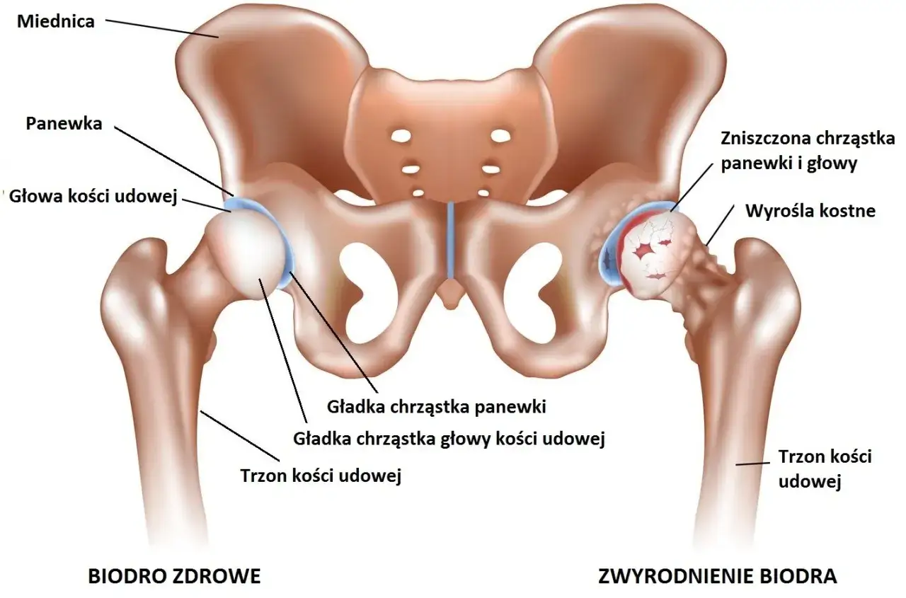anatomia stawu biodrowego ból