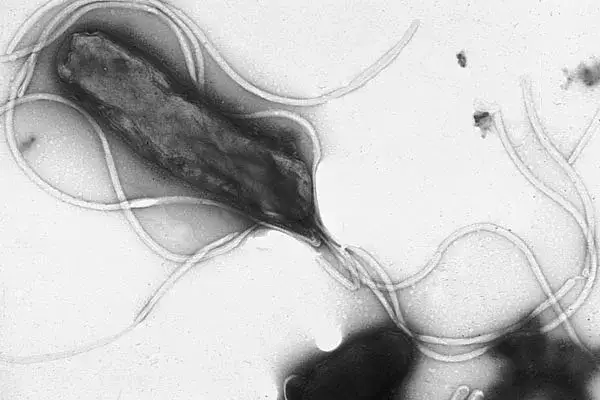 Bakteria Helicobacter pylori pod mikroskopem