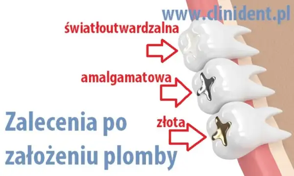 Alkohol po plombowaniu: Odczekaj 24h! Dlaczego to ważne?