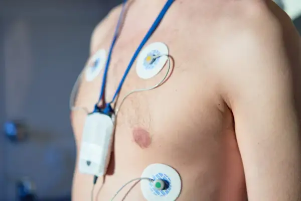 Mężczyzna z elektrodami EKG na klatce piersiowej i podłączonym urządzeniem. To badanie holterowskie, które pomaga ocenić pracę serca.