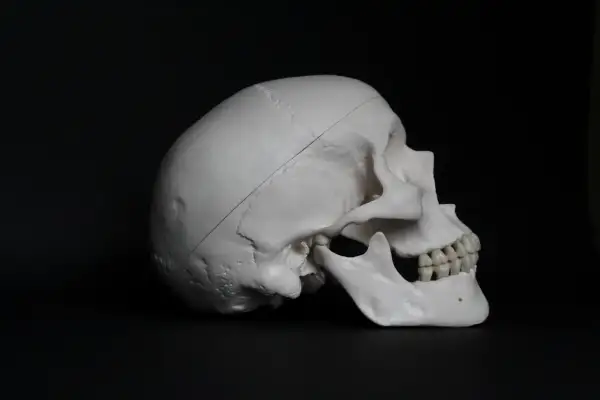 Model ludzkiej czaszki z widoczną linią wskazującą na potencjalną trepanację czaszki.